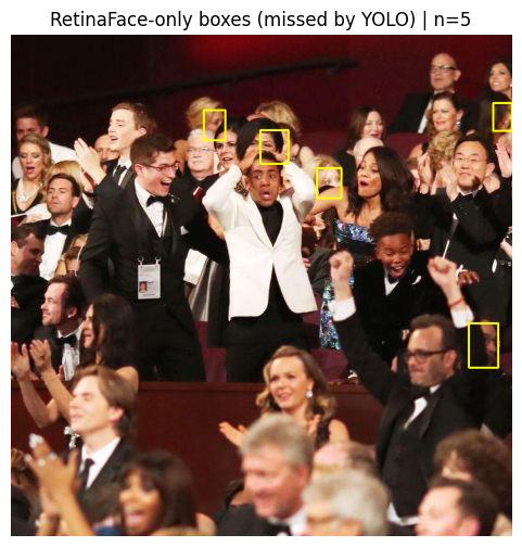 Face Detection Comparison: RetinaFace vs YOLOv8